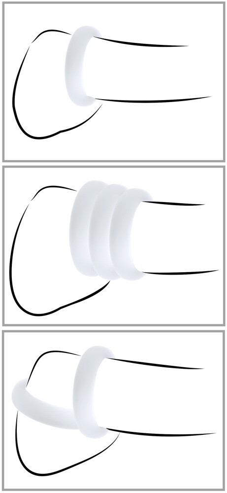Silicone Rings Set of 3